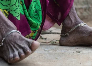 Maladies Tropicales Négligées : le financement, un frein à la lutte